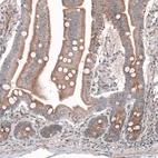 Immunohistochemical staining of human duodenum shows moderate cytoplasmic positivity in glandular cells.