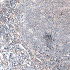 Immunohistochemical staining of human tonsil shows absence of positivity in lymphoid cells as expected (negative control).