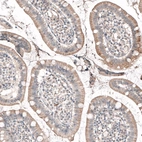 Immunohistochemical staining of human small intestine shows membranous positivity in glandular cells.