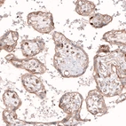 Immunohistochemical staining of human placenta shows membranous positivity in trophoblast.