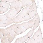 Immunohistochemical staining of human skeletal muscle shows absence of membranous positivity in skeletal muscle fibers as expected (negative control).