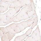 Immunohistochemical staining of human skeletal muscle shows absence of membranous positivity in skeletal muscle fibers as expected (negative control).