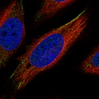 Immunofluorescence staining of HeLa cells using the Anti-ROR2 monoclonal antibody, showing specific staining in the plasma membrane in green. Microtubule- and nuclear probes are visualized in red and blue, respectively (where available).