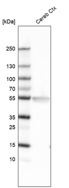 Western blot analysis in human cerebral cortex tissue.
