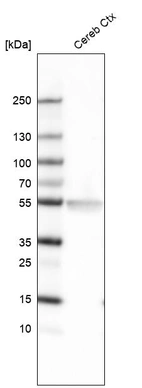 Western blot analysis in human cerebral cortex tissue.