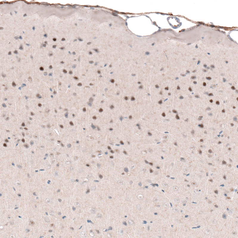 Anti-POU3F2 Antibody