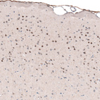 Anti-POU3F2 Antibody