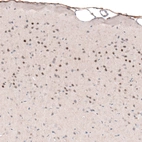Anti-POU3F2 Antibody