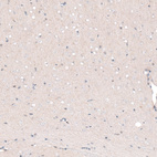 Immunohistochemical staining of mouse brain shows no nuclear positivity in neurons in cortical layers 5-6 as expected.