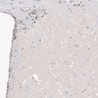 Immunohistochemical staining of mouse forebrain shows nuclear positivity in a subset of cells in the lateral ventrical wall.