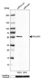 Western blot analysis in HEK293 cells transfected with control siRNA, target specific siRNA probe #1, using Anti-POU3F2 antibody. Remaining relative intensity is presented. Loading control: Anti-GAPDH.