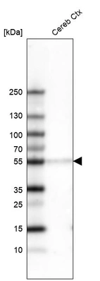 Western blot analysis in human cerebral cortex tissue.