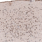 Immunohistochemical staining of mouse cerebral cortex shows strong nuclear positivity in neurons in layers 2-4.