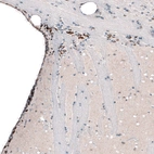 Immunohistochemical staining of mouse brain shows strong nuclear positivity in neurons in the lateral ventricle wall.