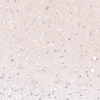 Immunohistochemical staining of rat cerebral cortex shows no nuclear positivity in neurons in layer 6 as expected.