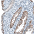 Immunohistochemical staining of human endometrium shows moderate to strong membranous positivity in glandular cells.