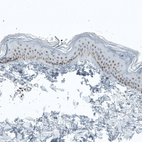 Immunohistochemical staining of human skin shows moderate to strong nuclear positivity in dermal cells.