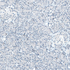 Anti-BCL11B Antibody