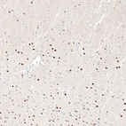 Immunohistochemical staining of mouse cerebral cortex shows moderate to strong nuclear positivity in neurons, mainly in layers 5-6.