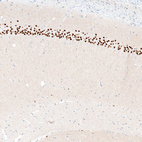 Anti-BCL11B Antibody