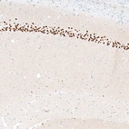 Immunohistochemical staining of mouse hippocampus shows strong nuclear positivity in neurons in CA1 pyramidal layer.