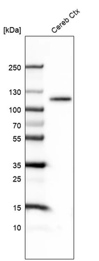 Western blot analysis in human cerebral cortex tissue.