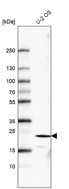Anti-FGF21 Antibody