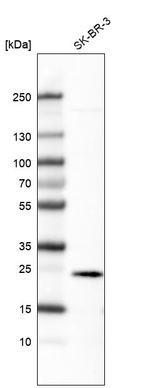 Anti-EFNA1 Antibody