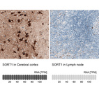 Anti-SORT1 Antibody