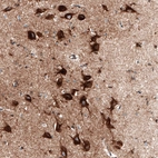 Immunohistochemical staining of human cerebral cortex shows strong cytoplasmic positivity in neurons.