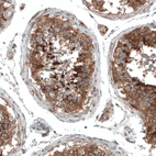 Immunohistochemical staining of human testis shows strong cytoplasmic positivity in cells in seminiferous ducts.
