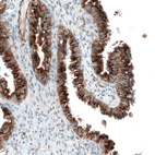 Anti-SORT1 Antibody