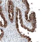 Immunohistochemical staining of human fallopian tube shows moderate to strong cytoplasmic positivity in glandular cells.