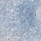 Immunohistochemical staining of human lymph node shows only weak positivity in a subset of lymphoid cells, as expected.