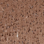 Immunohistochemical staining of mouse cerebral cortex shows strong cytoplasmic positivity in neurons.