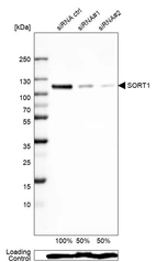 Western blot analysis in Rh30 cells transfected with control siRNA, target specific siRNA probe #1 and #2, using Anti-SORT1 antibody. Remaining relative intensity is presented. Loading control: Anti-GAPDH.