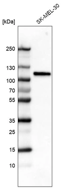 Western blot analysis in human cell line SK-MEL-30.