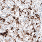 Anti-PRL Antibody