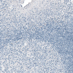 Immunohistochemical staining of human tonsil shows no positivity in lymphoid cells as expected.