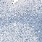 Immunohistochemical staining of human tonsil shows no positivity in lymphoid cells as expected.