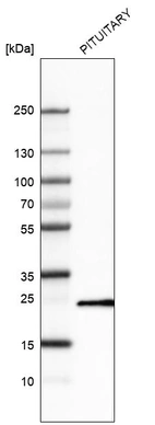 Western blot analysis in human pituitary gland tissue.