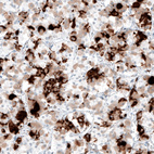 Anti-PRL Antibody