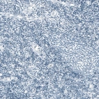 Immunohistochemical staining of human tonsil shows no positivity in lymphoid cells as expected.
