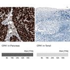 Anti-CPA1 Antibody