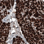 Immunohistochemical staining of human pancreas shows strong cytoplasmic positivity in exocrine glandular cells.