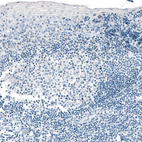 Immunohistochemical staining of human tonsil shows no positivity in lymphoid cells as expected.