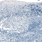 Immunohistochemical staining of human tonsil shows no positivity in lymphoid cells as expected.