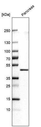 Western blot analysis in human pancreas tissue.