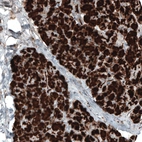 Immunohistochemical staining of human pancreas shows strong cytoplasmic positivity in exocrine glandular cells.