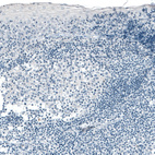 Immunohistochemical staining of human tonsil shows no positivity in lymphoid cells as expected.